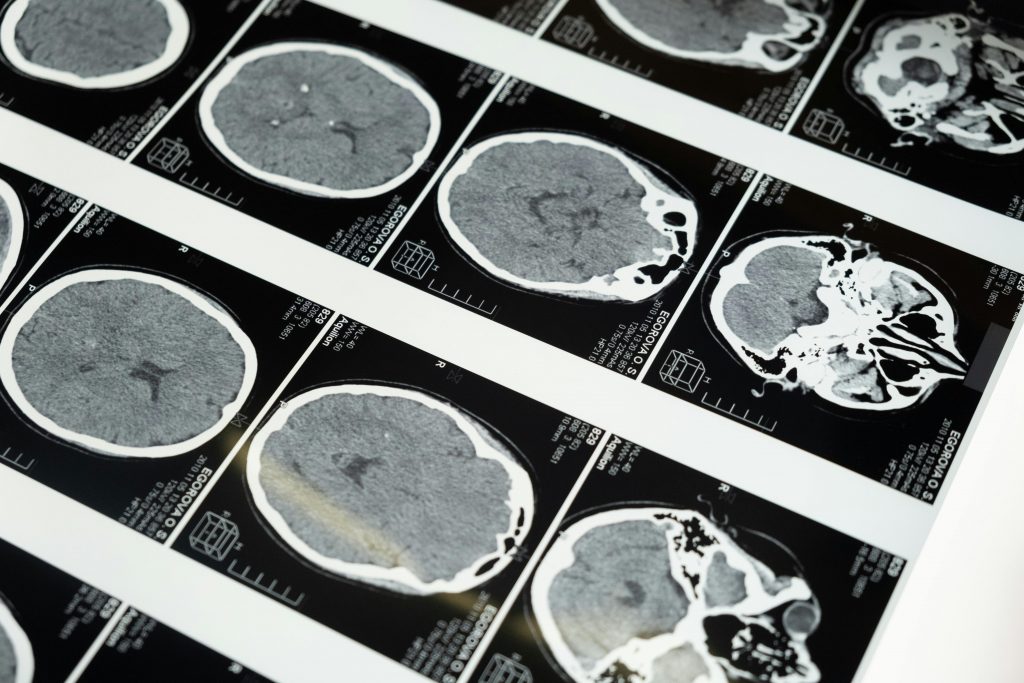 Imagerie cerebrale montrant l’anatomie du cerveau